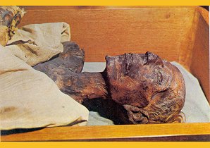 Mummy Of Ramses II. The Egyptian Museum. Cairo Egypt. Travels & Tours. Pictures, Photos, Images, Descriptions, Information, & Reviews.